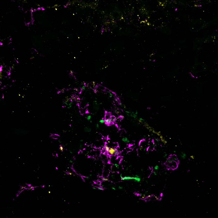 Pancreatic islet, fluorescence microscopy, Parchem Lab