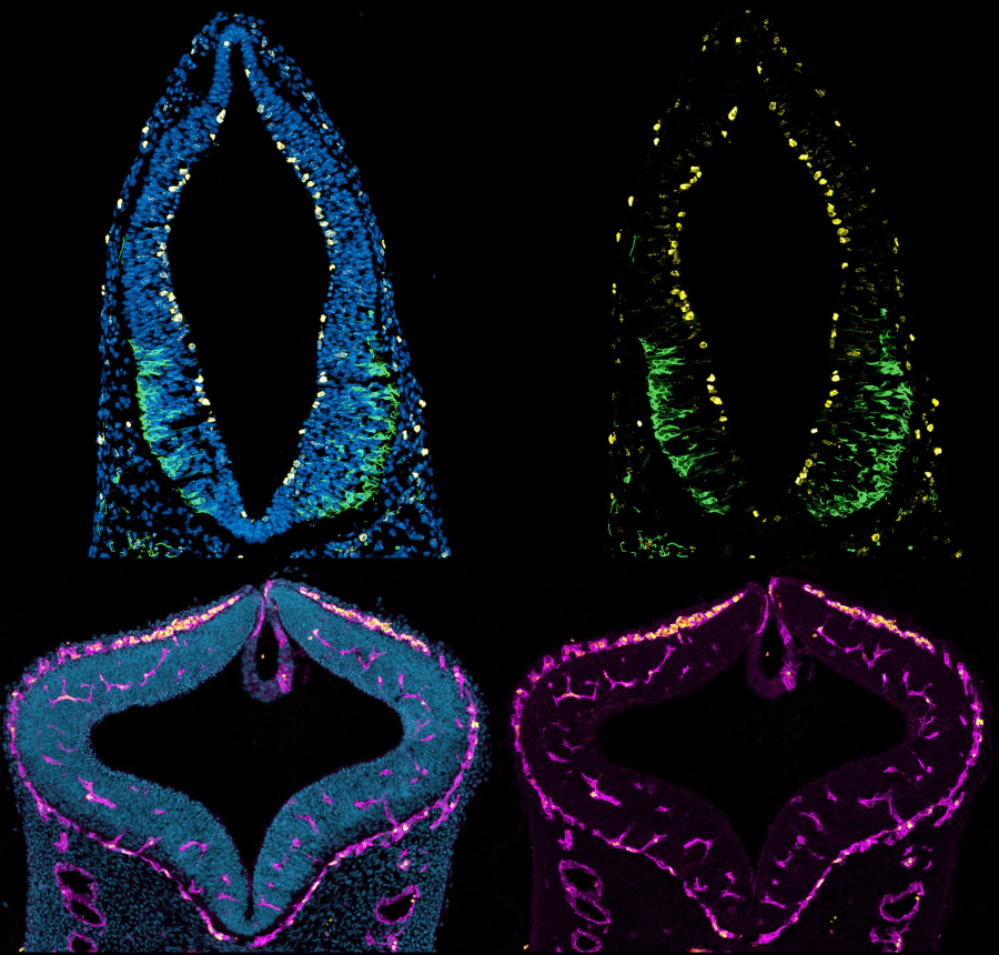 Neural tube cross-sections, fluorescence microscopy, Parchem Lab